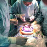 Fetalchirurgie: Wenn das Baby im Bauch krank ist Fetalchirurgische Operation