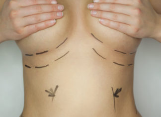 Mammaaugmentation – die OP zur Vergrößerung der Brust Brustvergrößerung